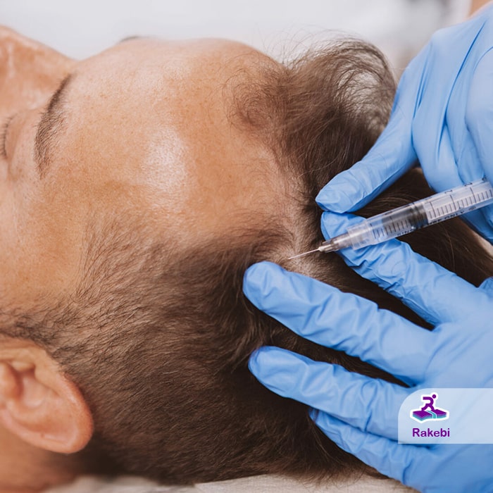 مزیت ‌های شگفت‌انگیز پی آر پی مو که باید قبل از درمان بدانید