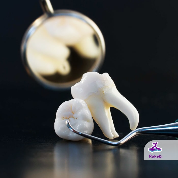 چرا کشیدن دندان عقل امری ضروری است؟