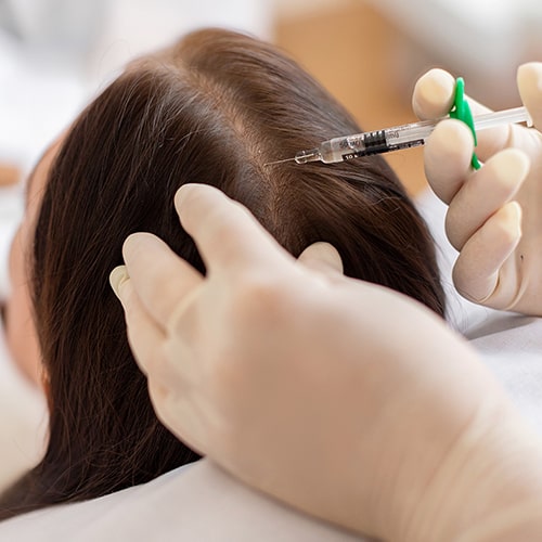 هیرفیلر-چیست-و-چگونه-انجام-می‌شود؟-min