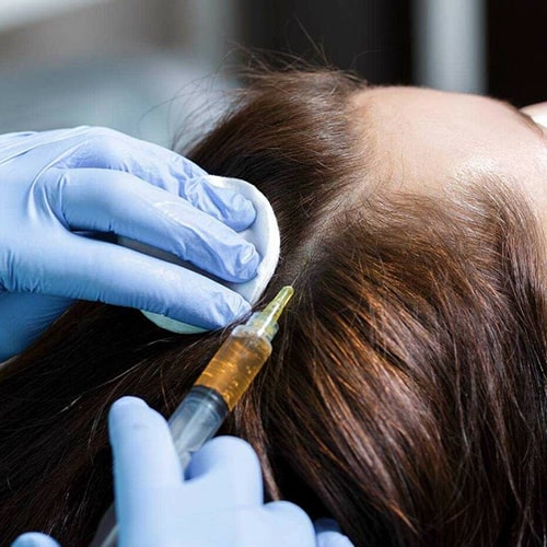 تفاوت-پی-آر-پی-با-روش‌های-قدیمی-درمان-ریزش-مو-min