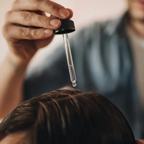 درمان-پوسته-سر-راهکارهای-موثر-خانگی-و-پزشکی-min