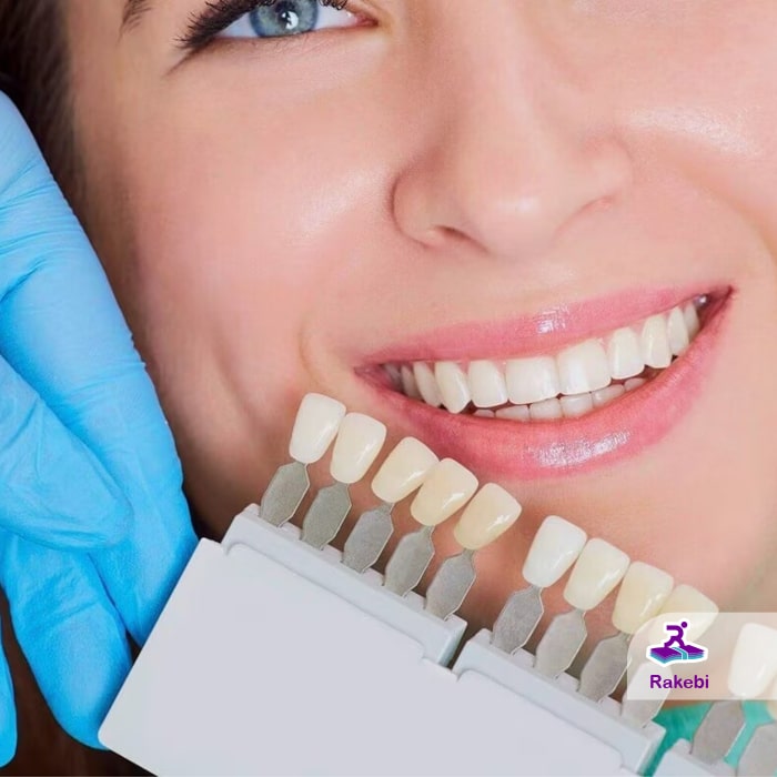 کامپوزیت یا لمینت؟ تفاوت این دو روش زیبایی دندان را بشناسید