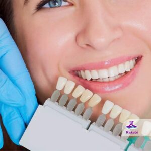 کامپوزیت یا لمینت؟ تفاوت این دو روش زیبایی دندان را بشناسید