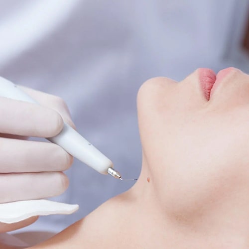 روشهای مختلف از بین بردن لکه ها و نحوه انجام آنها در دقیقه