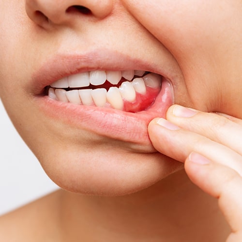 چطور-بیماری‌های-لثه-دندان‌ها-را-شل-می‌کنند؟-min