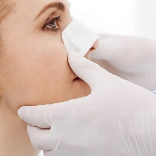 چگونه-کاهش-حجم-بینی-باعث-برجسته‌تر-شدن-گونه‌ها-می‌شود؟-min