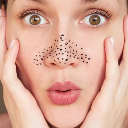 چرا چرب شدن پوست بینی بعد از عمل رخ می دهد؟