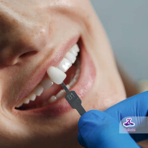 تعویض روکش دندان چگونه انجام می‌شود