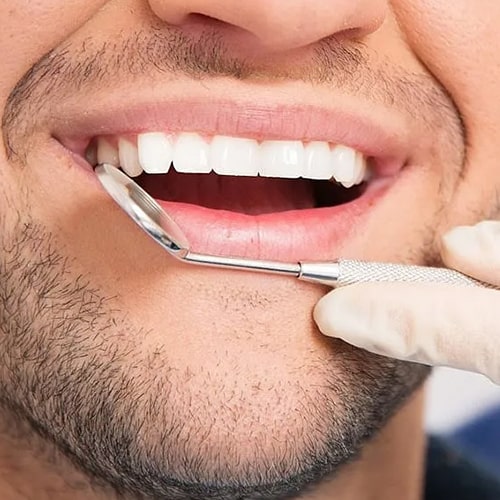 تفاوت-کامپوزیت-و-لمینت-مزایا-و-معایب-min