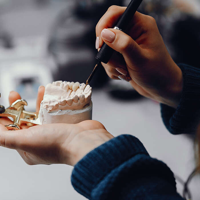 مراحل روکش دندان عصب‌کشی شده از صفر تا صد