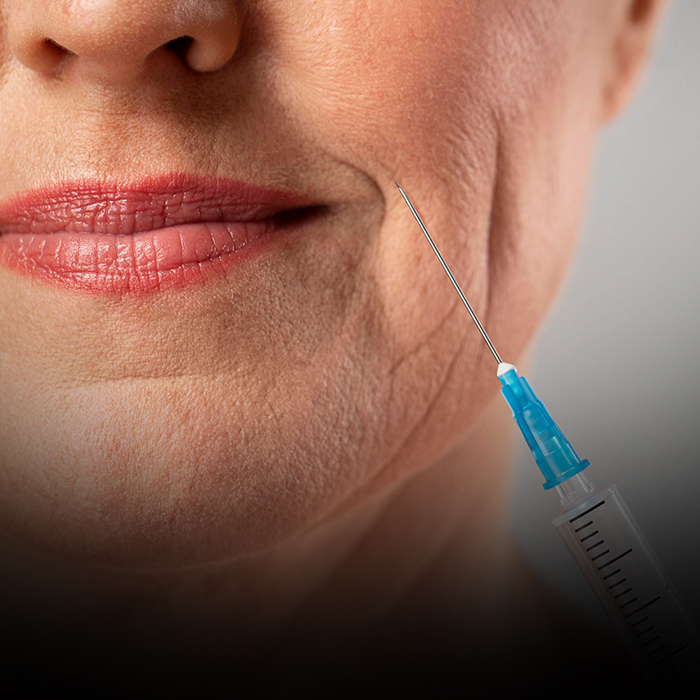 تحلیل عوارض تزریق فیلر صورت: علمی، کاربردی و پیشگیرانه