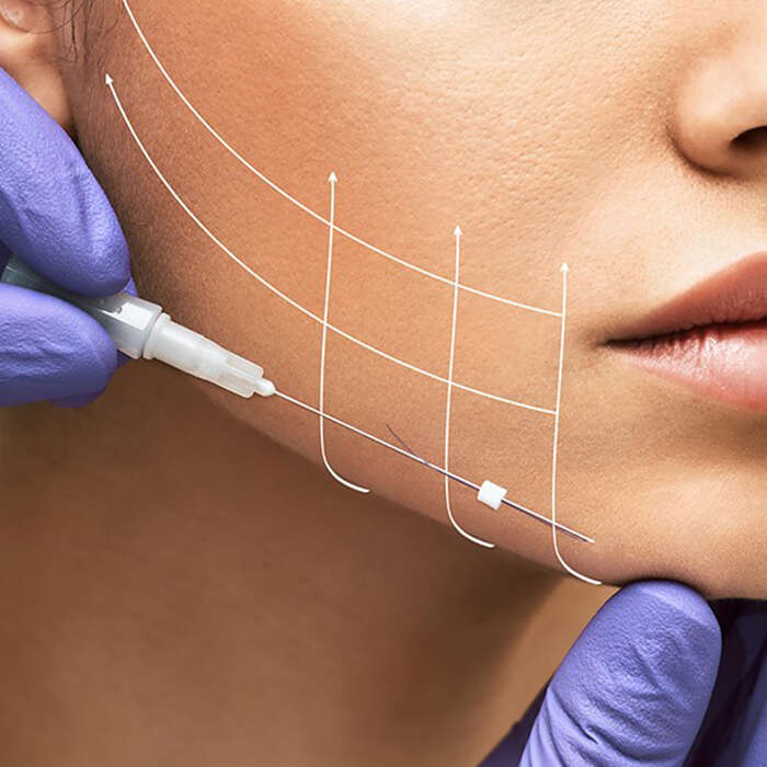 مقایسه هایفوتراپی و لیفت با نخ: کدام روش بهتر است؟
