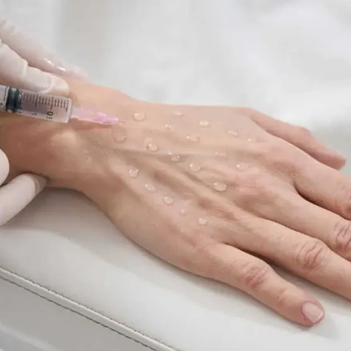 مقایسه آر اف با روش‌های سنتی جوانسازی پوست دست