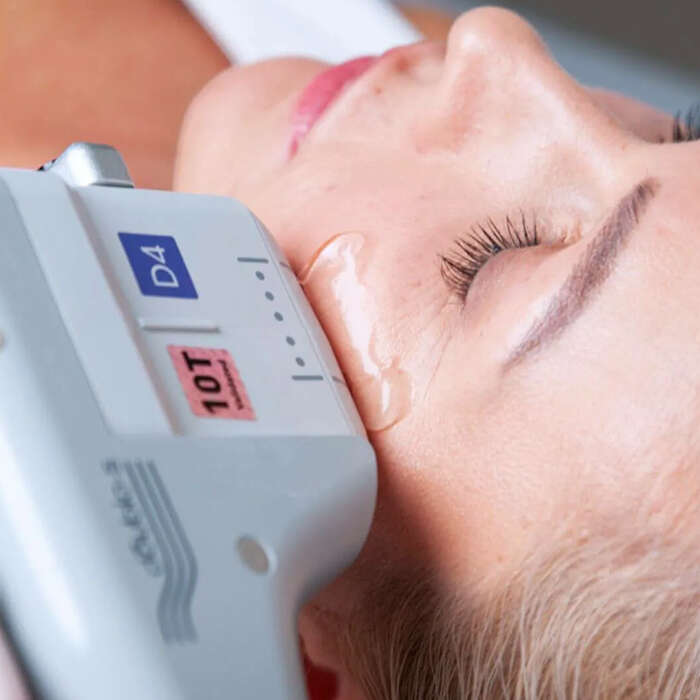 ماندگاری هایفوتراپی و لیفت با نخ چقدر است؟