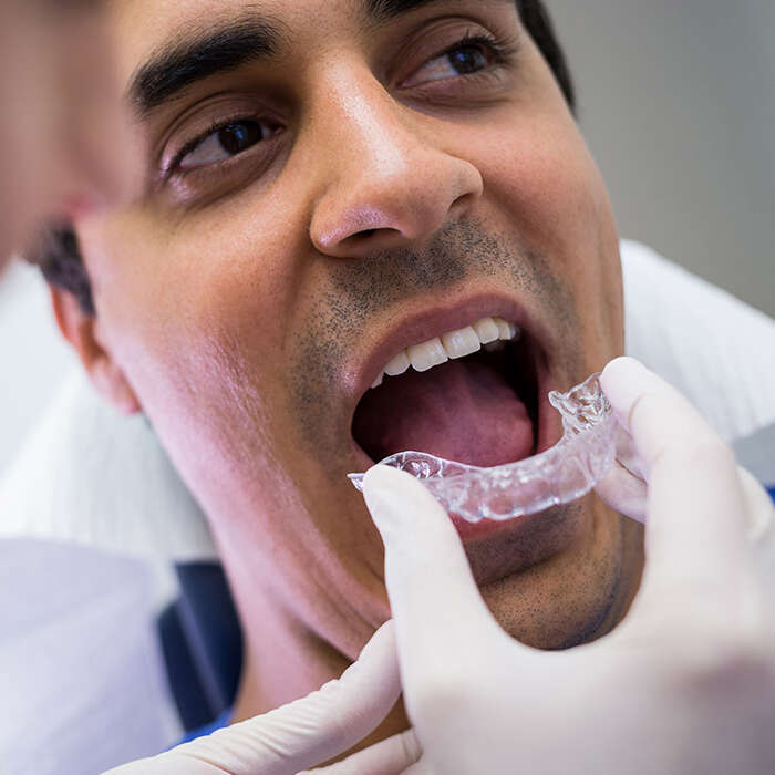 مراحل روکش دندان عصب‌کشی شده از صفر تا صد