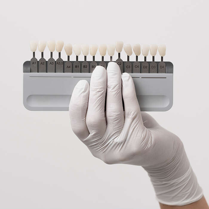 ساختار و ترکیب لمینت زیرکونیومی