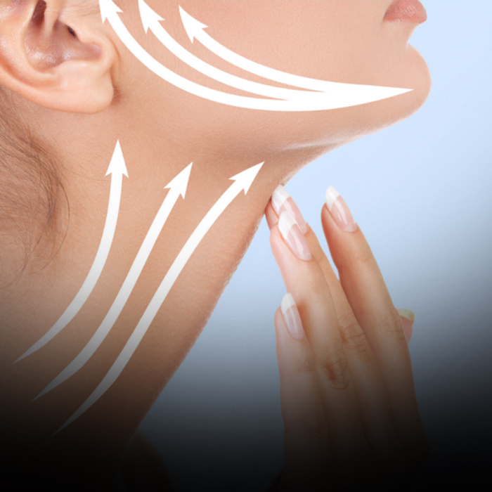 معایب و محدودیتهای لیفت نوری کم تهاجمی عبارتاند از: