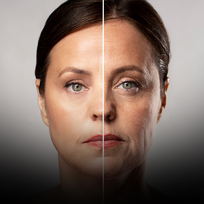 انواع اندولیفت و کاربردهای هر کدام